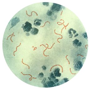tracheite batterio streptococco
