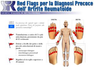 artrite reumatoide red flags
