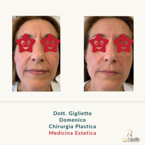 Dottor Domenico Giglietto Centro San Camillo Medicina Estetica