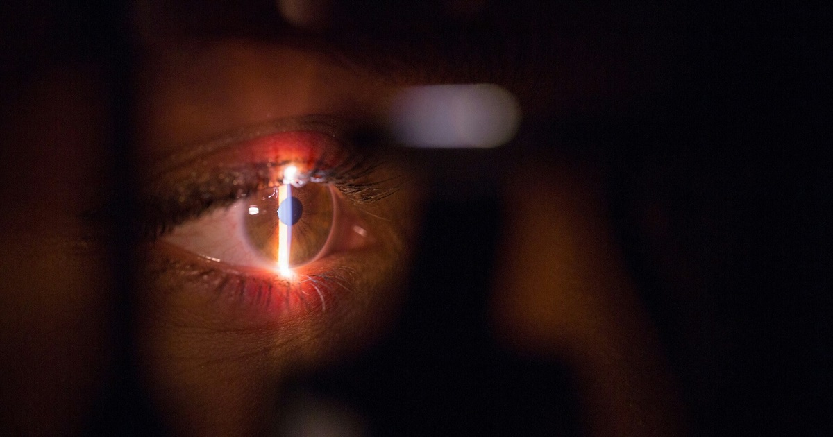 laser yag laser yag cos'è
